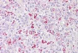 PFKFB2 Antibody, Novus Biologicals 0.1mg; Unlabeled:Antibodies, Polyclonal